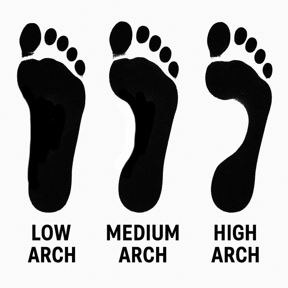 Different types of arches - low arch, medium arch and high arch